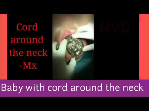 download lagu mp3 mp4 Nvd, download lagu Nvd gratis, unduh video klip Nvd
