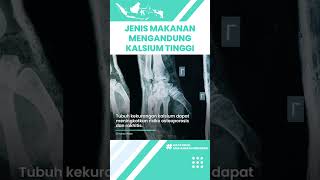 Inilah Jenis Makanan yang Tinggi Kalsium yang Bisa Cegah Penyakit Sendi: Keju hingga Almond