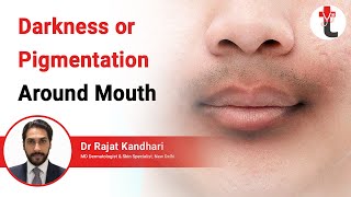 Darkness or Pigmentation Around Mouth || Darkening Around Mouth Causes | Treatment | Dermatologist