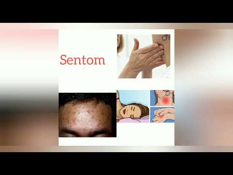 Men tout sentom yon moun ki gen VIH(sida) ap genyen, men ki prevansyon ou ka fè pou pa pranl😥