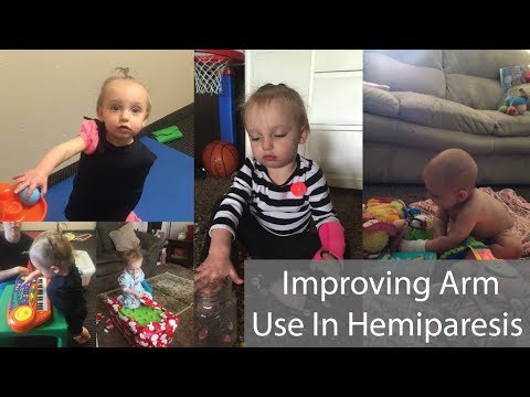 Watch lagu Images Videos Cerebral Palsy Spastic Hemiplegia, Watch Images Cerebral Palsy Spastic Hemiplegia free Watchn, video klip Cerebral Palsy Spastic Hemiplegia