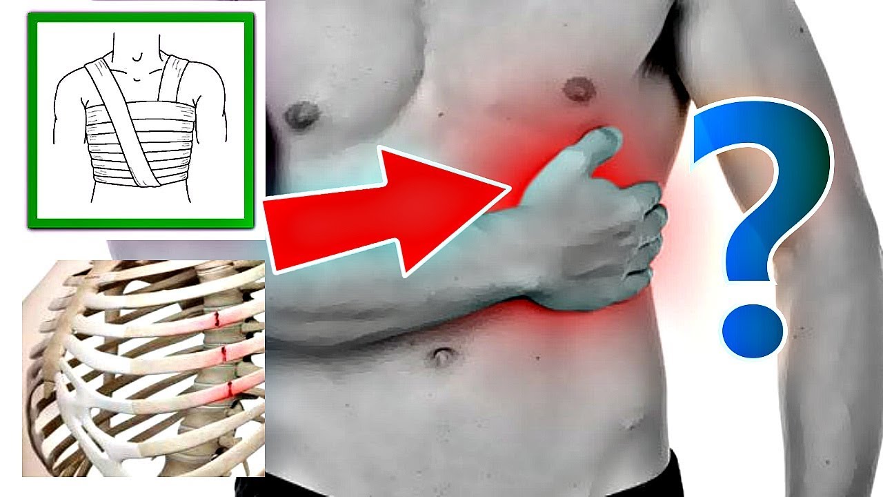 Как отличить перелом ребер от ушиба Как определить перелом ребра или ушиб