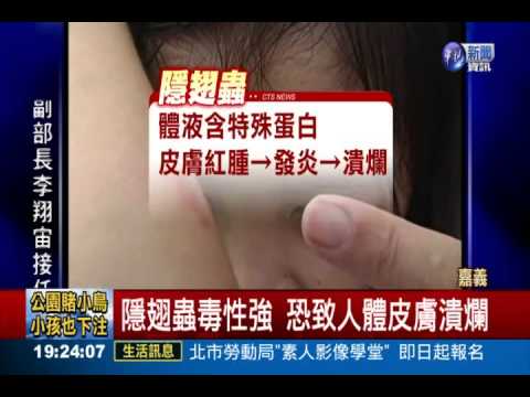 夏日毀容殺手 隱翅蟲出沒高鐵站