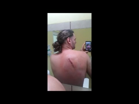 Gimnastyka w koślawego deformacji stóp u dzieci Wkładki z szpotawe stopy deformacji u dzieci