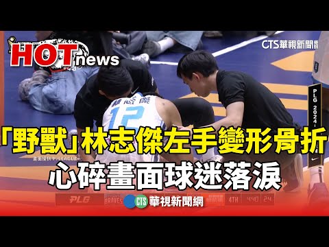 「野獸」林志傑左手變形骨折　心碎畫面球迷落淚