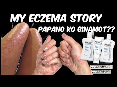 Kung paano sa paggamot sa isang halamang-singaw Sink pamahid para sa kuko halamang-singaw