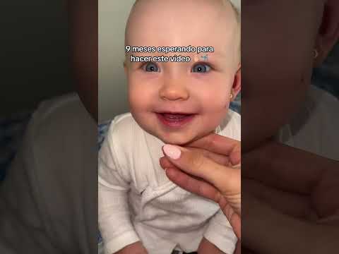 Con que tiempo os salió vuestro primer diente? 🦷👶🏼