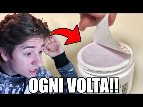 Togliere il perossido di idrogeno di lentiggini La decolorazione sbatte la Sua grazia fino a rendere cremoso
