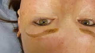 Alopecia Eyebrows Microblading by El Truchan @ Perfect Definition in London