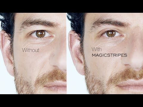 WWW.MAGICSTRIPES.COM - Immediate Eyelid Lifting Without Surgery