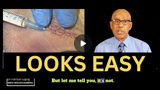 ⚠️ Microsclerotherapy Beginners: DON'T Inject Ankle Spider Veins! (Here's Why) ⚠️ Doctors and Nurses