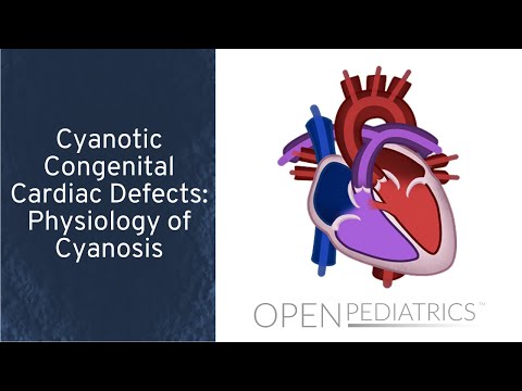Cyanotic Congenital Cardiac Defects: Physiology of Cyanosis by T. Kulik, et al. | OPENPediatrics