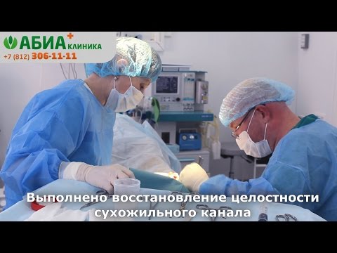 Удаление гигромы голеностопного сустава. Клиника "АБИА"