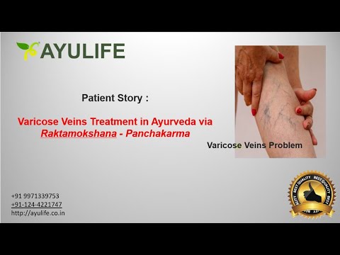 Fertility support success