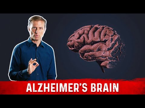 Do You Have Copper Toxicity