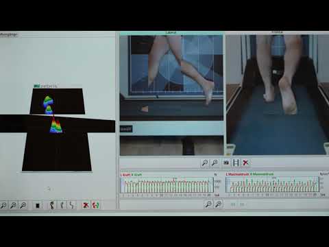 Spreizfuß beim Laufen