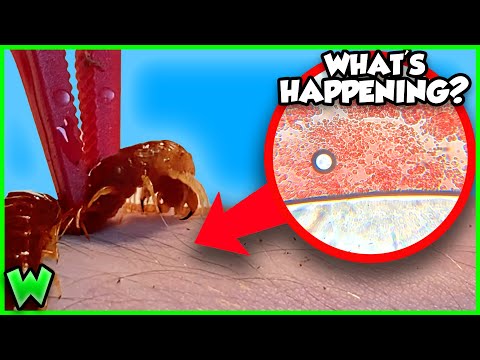 How Dangerous Are Centipede Bites?