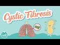 Cystic Fibrosis Pathology Treatment Management MedSurg Help For Nursing Students