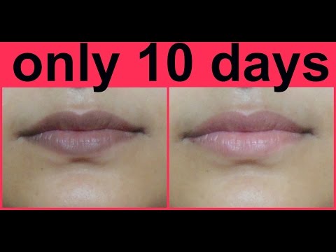 Remove Darkness From Lips Forever | Lighten Your Lips Naturally In 10 Days Video