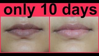 how to lighten dark lips naturally at home.(hindi)/होठों के कालापन लिए घरेलू उपचार