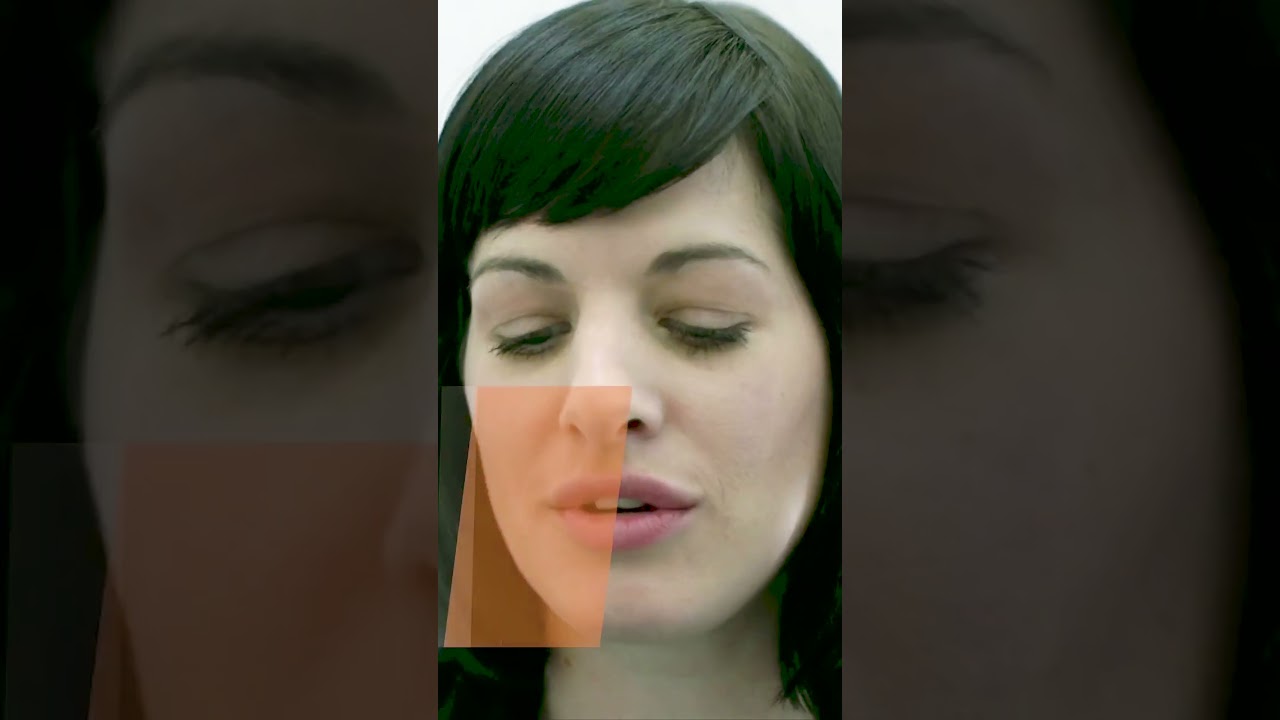 What Causes Optic Nerve Damage? Can Stem Cells Help? | Future of Medicine | Eye Diseases |