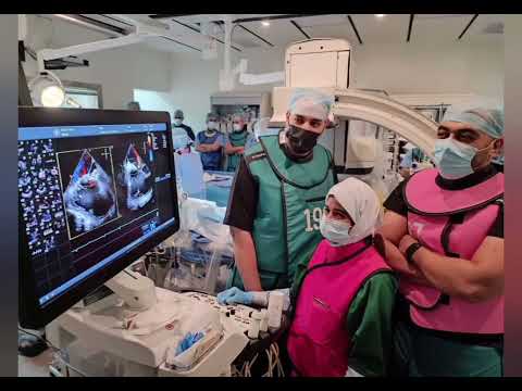 TRICValve implant .. BiCaval Valve .. #TEE #toe #echo