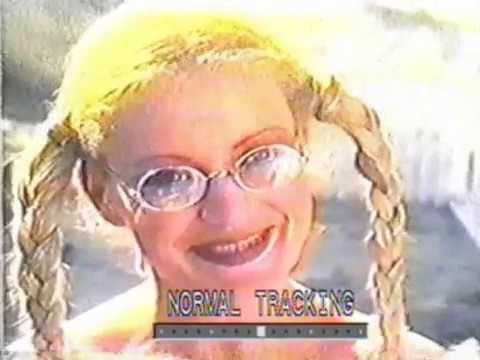 Dolly Had Braces TV Broadcast Sun Nov 22 1981