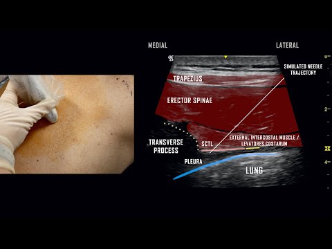 Practical Anesthesia Techniques
