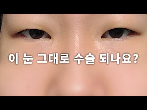 单眼皮 01