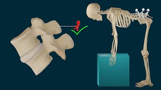 Músculos Erectores Espinales