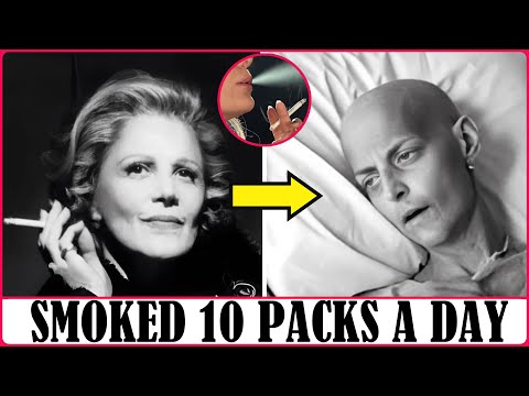 28 Celebrities Who Passed Away from Heavy Smoking in Hollywood | Try Not To Gasp Them Today!