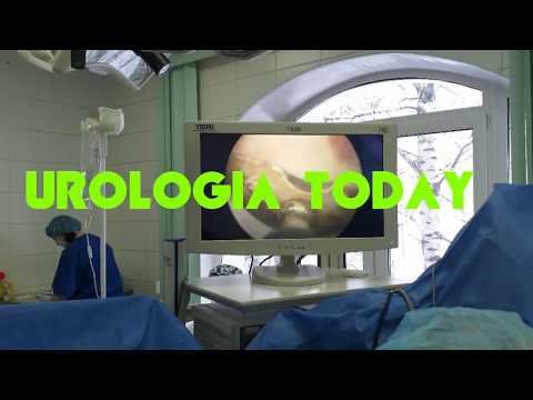 Urología  today video PROMO