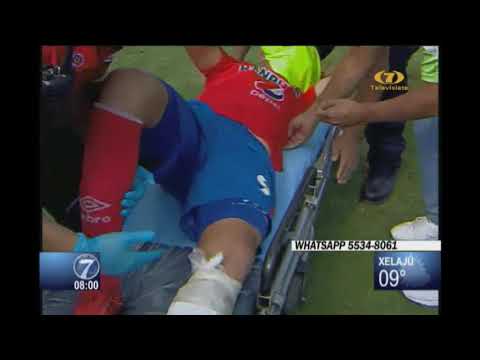 José Carlos Martínez sufrió lesión de tibia