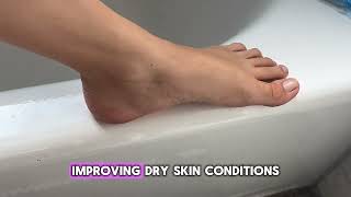 Derm 42 for dry, cracked, and callused feet.