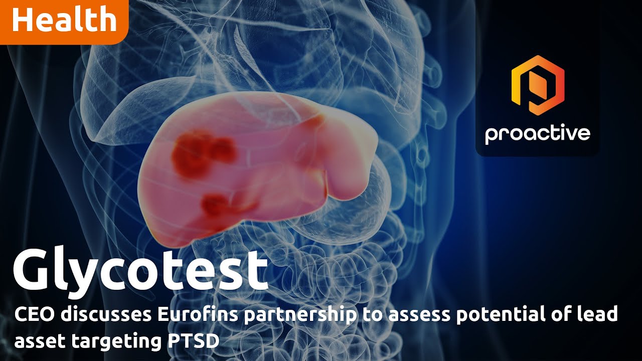 Glycotest CEO discusses University of Georgia partnership for early liver cancer detection
