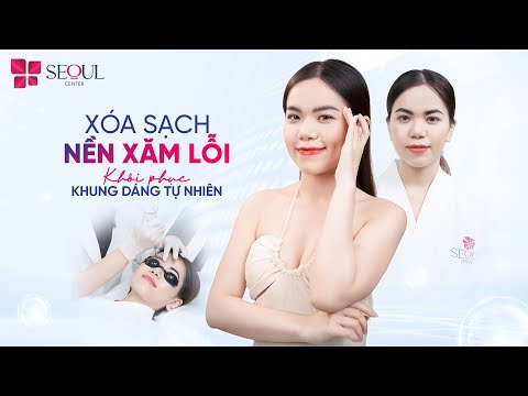 Nền Xăm Lỗi Chỉ Là Chuyện Nhỏ Với Công Nghệ Xóa Xăm Và Dệt Sợi Hairstroke