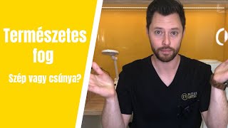Természetes fog - szép vagy csúnya?