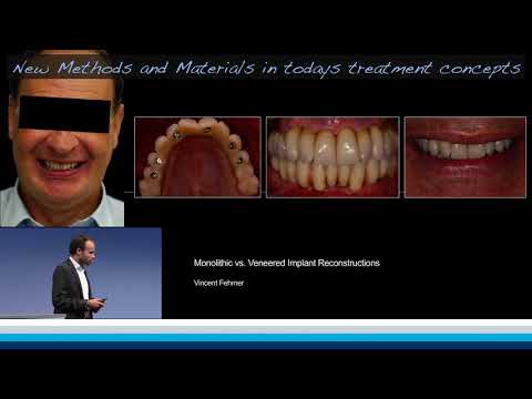 Monolithic vs. Veneered Implant Reconstructions | Vincent Fehmer
