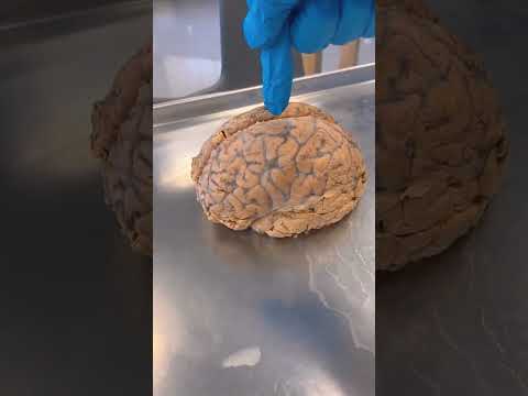 Cerebro Humano REAL