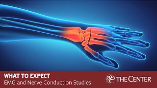 What to Expect During Nerve Conduction Studies and EMG Tests