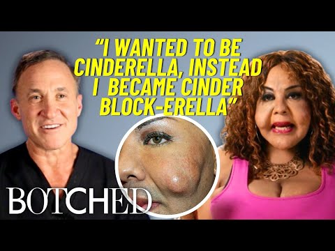 REJECTED by Botched: Rajee’s First Attempt At Removing Cement Filler Injections | Botched | E!