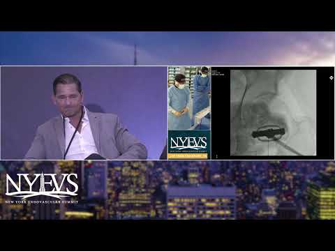 Live Case Presentation #1 Severely Calcific, Long Superficial Femoral Artery Cto Intervention   C  M