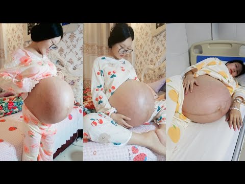 Bumil triplets || compilation