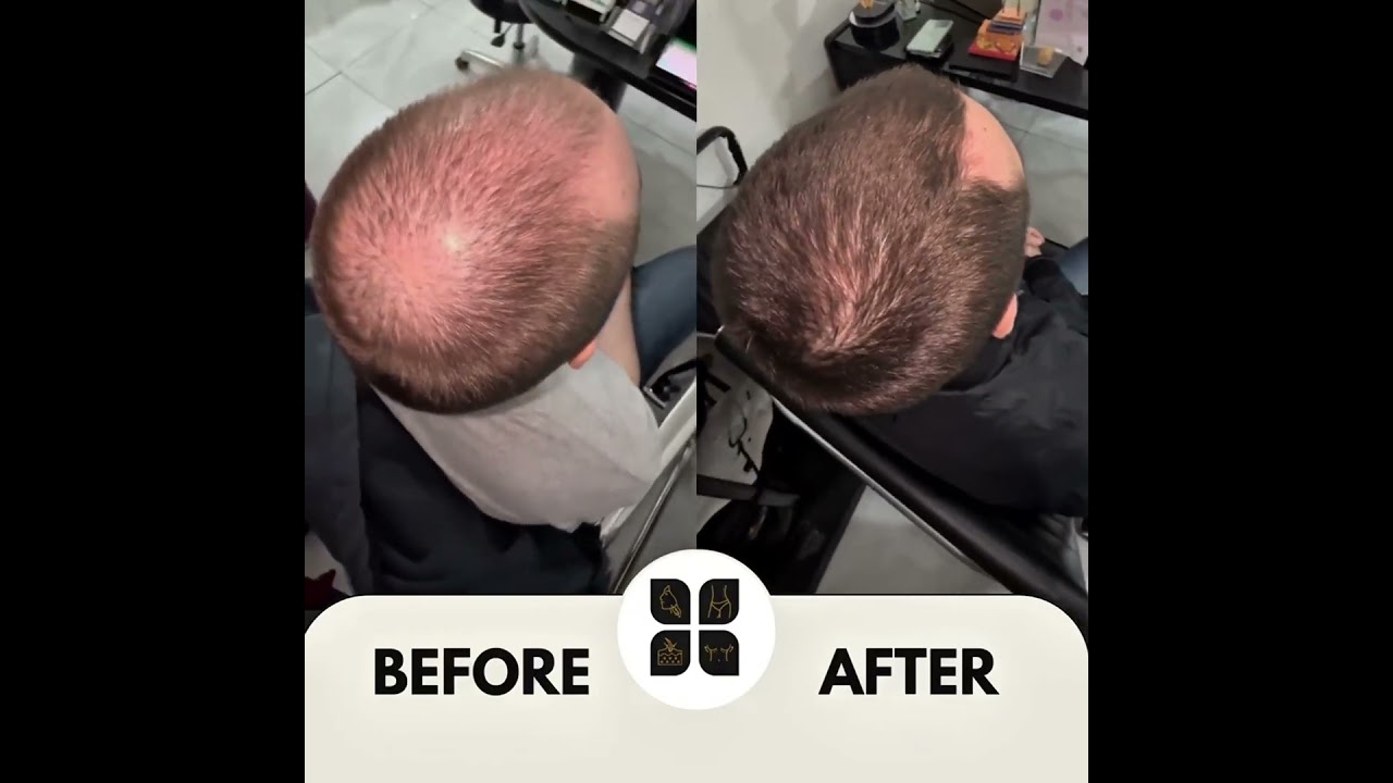 Carlos Alberto Magaña Bustamante-74