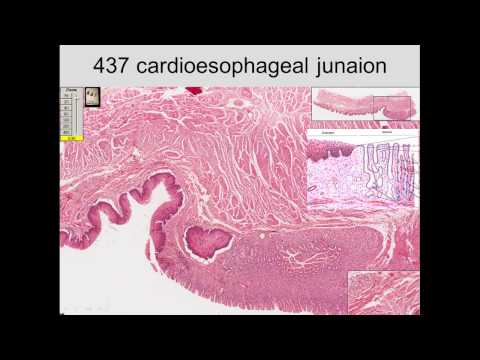 17. Digestive System