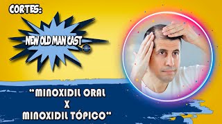 Vantagens e Desvantagens do Minoxidil Oral | Cortes New Old Man Cast