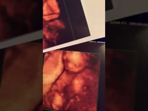 19 week 4D ultrasound photos