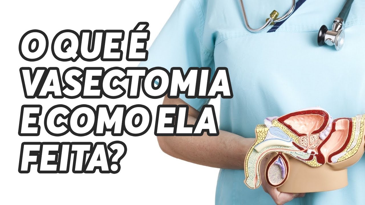 Assistir agora Vasectomia O Que é Vasectomia O Que é