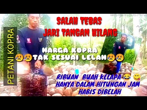 SALAH TEBAS JARI TANGAN HILANG.RESIKO PETANI KOPRA  HALMAHERA UTARA