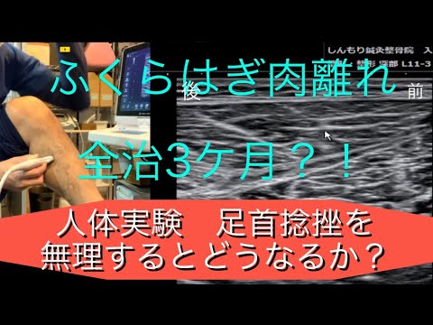 【人体実験②】ふくらはぎ肉離れエコー　大きさ